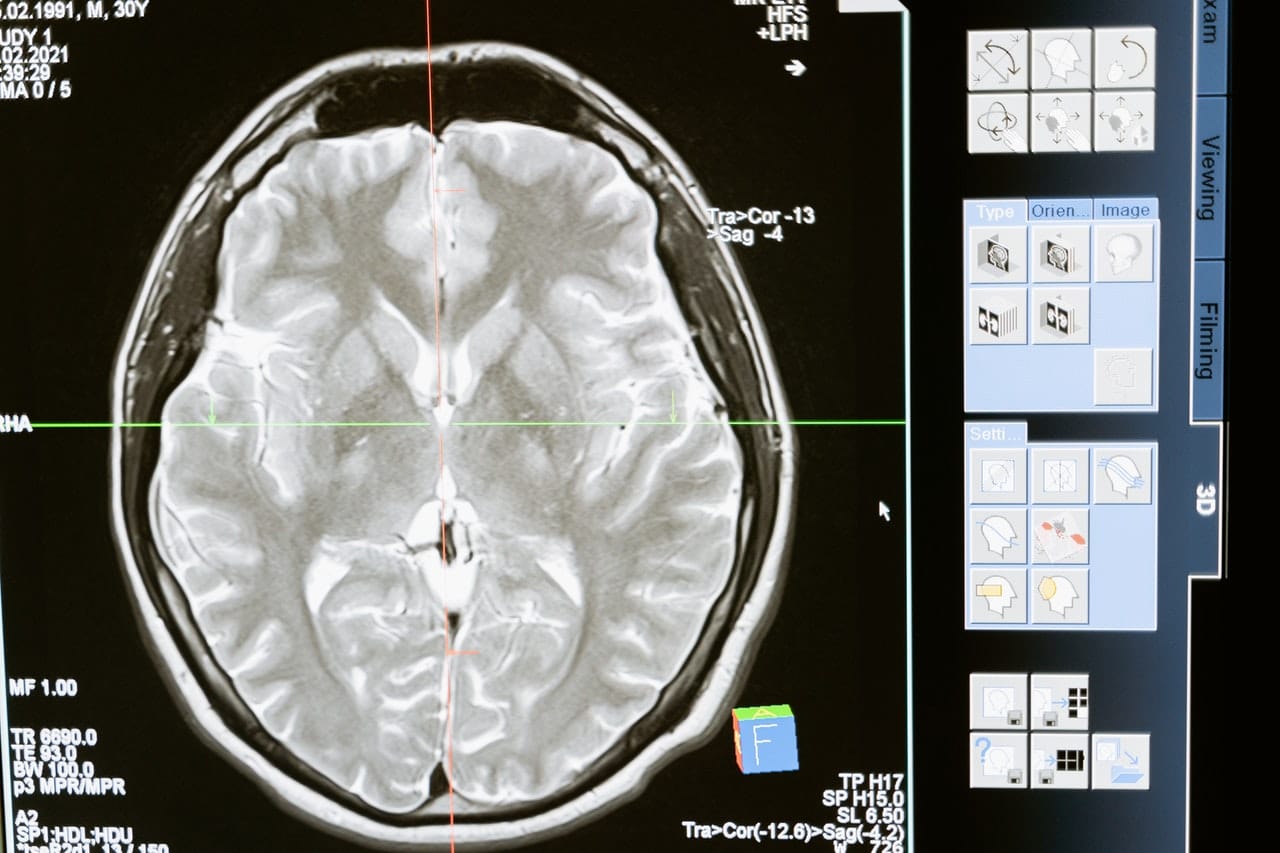 Desarrolladoras de AlfaPeople Ecuador y su proyecto de Deep Learning aplicado al cerebro
